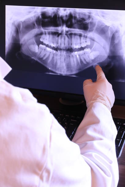 Best Emergency Dental Care for Broken or Chipped Teeth in Brookdale, SC